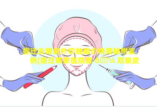 宿迁去眼袋外切抽脂价格揭秘附案例(宿迁哪家医院做 🐼 双眼皮手术比较好)